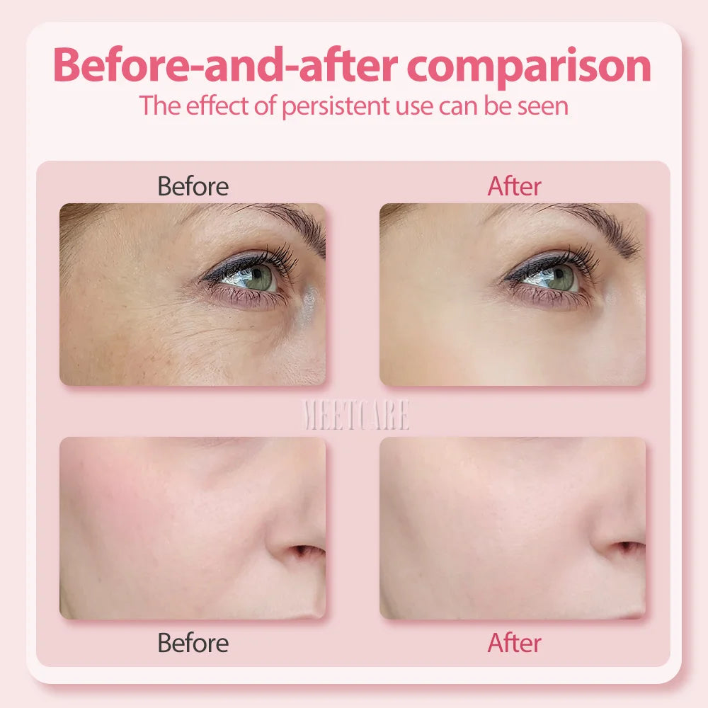 4in1 Eye Facial Massage Wand EMS Hot Compress Red Light Neck Face Vibration Lift Skin Rejuvenation Sculpting Firm Tighten Tool