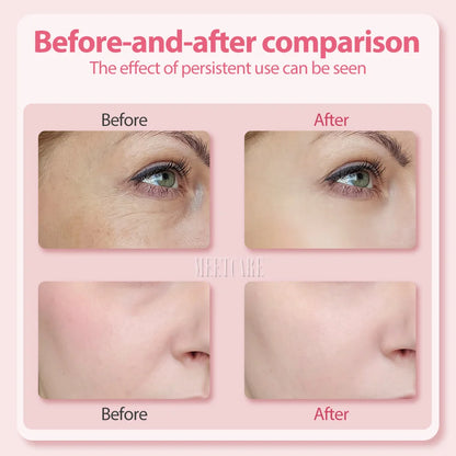 4in1 Eye Facial Massage Wand EMS Hot Compress Red Light Neck Face Vibration Lift Skin Rejuvenation Sculpting Firm Tighten Tool